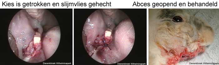 De voorste kies wordt getrokken en het slijmvlies gehecht